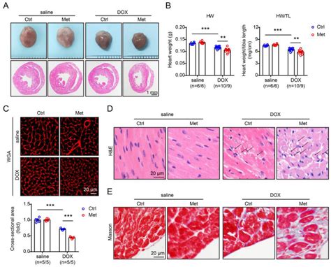 Hyperhomocysteinaemia Promotes Doxorubicin Induced Cardiotoxicity In Mice