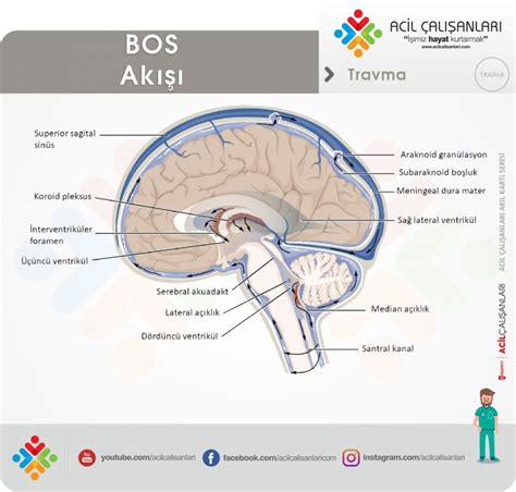 Serebral Ven Trombozu Sinüs Acil Çalışanları