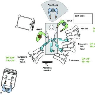 Pdf Case Series Of The Month Robot Assisted Radical Prostatectomy