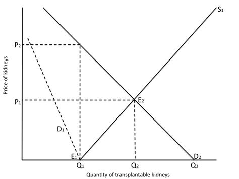 How Free Market Kidney Sales Can Save Lives—and Lower The Total Cost Of