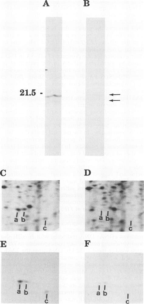 Gel Electrophoretic Analysis Of Eif 5a Forms Total Protein In Lysates