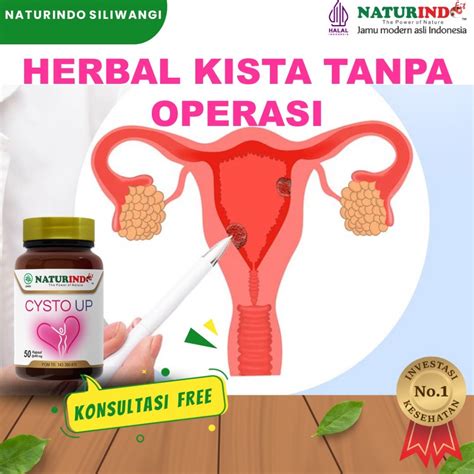 Jual Obat Kista Ovarium Bartholin Miom Herbal Kista Ganglion