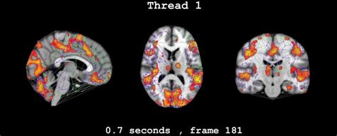 Frame Betti Number Area For A Rs Fmri Bold Signal Vortexes On Brain