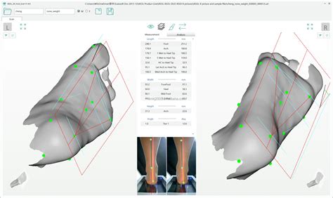 Xsol X Custom Diabetic Orthotic Insoles Shoes Cad D Printer Foot