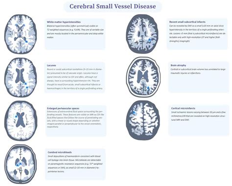 Frontiers Clinical Radiological And Pathological Characteristics