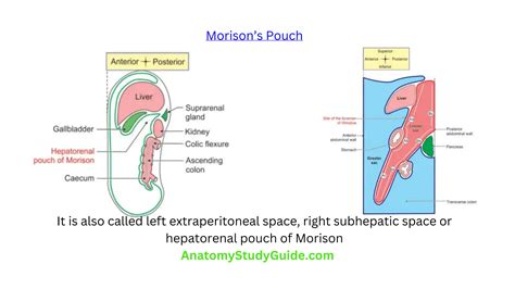 Foramen of Winslow (aditus to lesser sac, epiploic foramen) | PPT