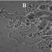 Light Microscopic Analysis Of Colony Edges Of P Aeruginosa In