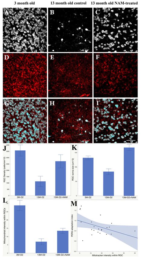 Nam Supplementation Rescues Retinal Ganglion Cell Rgc And