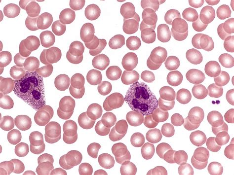 Red Blood Cells White Blood Cell Clipart Flyclipart