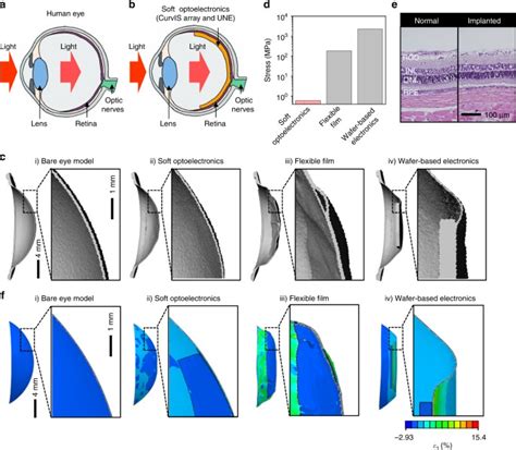 Human Eye Inspired Soft Optoelectronic Device Using High Density Mos