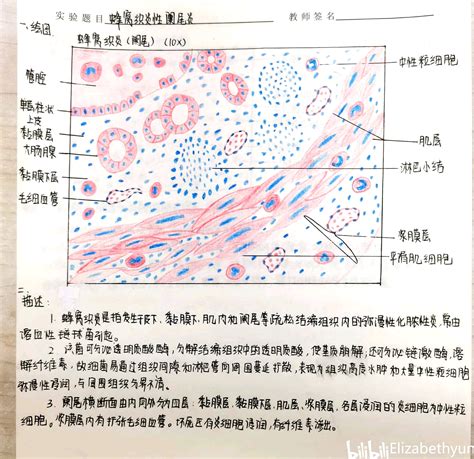 病理学切片红蓝铅笔画图 哔哩哔哩