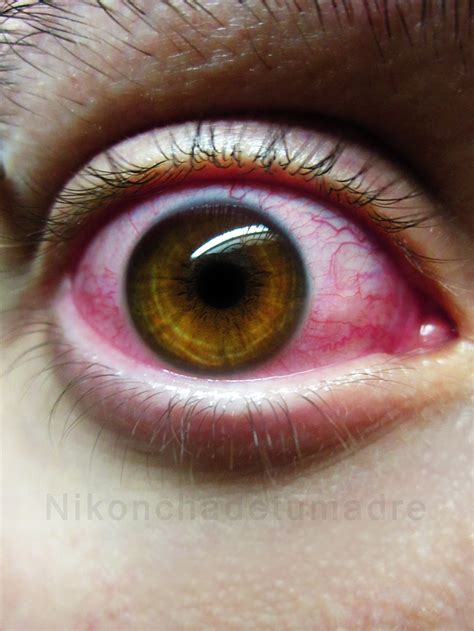 Bloody Eye by nikonchadetumadre on DeviantArt