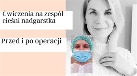 Ćwiczenia na zespół cieśni nadgarstka przed i po operacji Moje