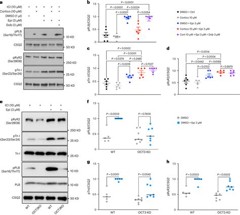 Plasma membrane and the Golgi pools of β1AR function differently in