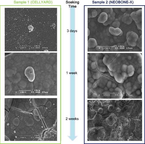 Sem Micrographs Of The Surface Of Two Kinds Of Ha Samples After Sbf