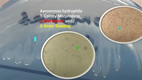 Aeromonas Hydrophila Colony Morphology Wet Mount And Gram Staining