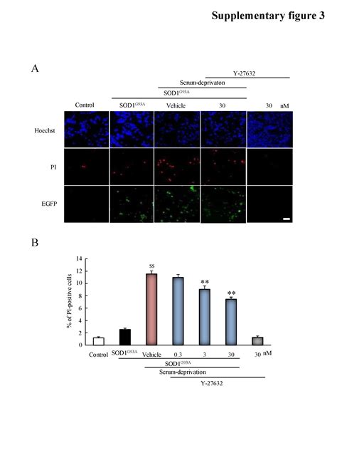 Fasudil A Rho Kinase Inhibitor Limits Motor Neuron Loss In