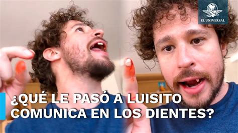 Se Le Caen Los Dientes A Luisito Comunica En Plena Transmisión En Vivo ¿fue Real O Es