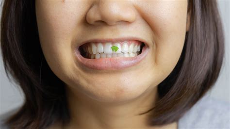 The Real Reason Spinach Gets Caught In Your Teeth