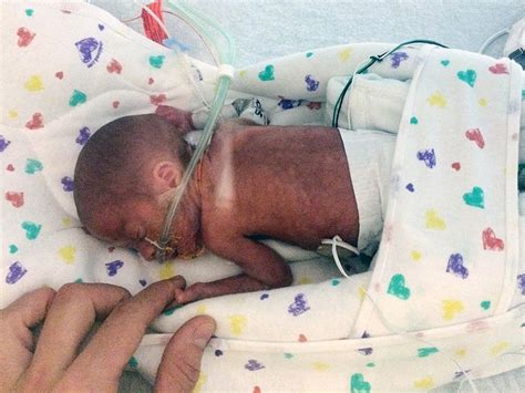 Miracle Baby! Born At Just 23 Weeks Old – Mother Narrates - Celebrities ...