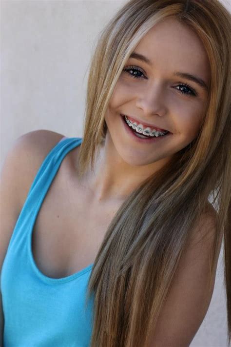 Acacia Brinley Long Hair Styles Cute Girls With Braces Brace Face