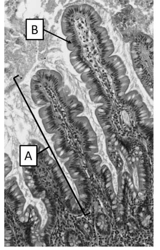 QROC Histologie du tube digestif du foie et du pancréas Cartes Quizlet