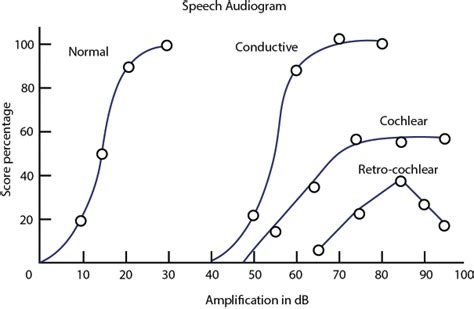 Different Types of Audiometry: Puretone, Speech, Tympanometry, OAE, ABR ...