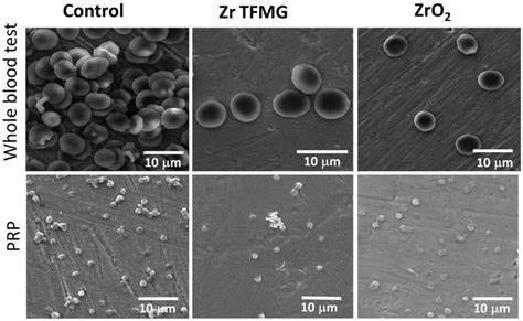 Blood Compatibility Studies For The Uncoated And Coated Specimens