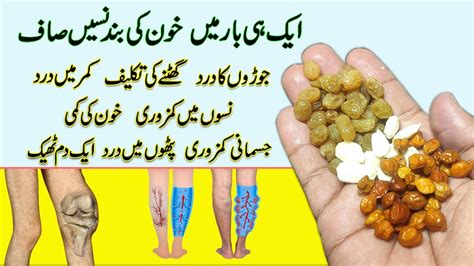 Easy Home Remedy Band Naso Ko Kholne Ka Ilajnarve Pain Joint Pain