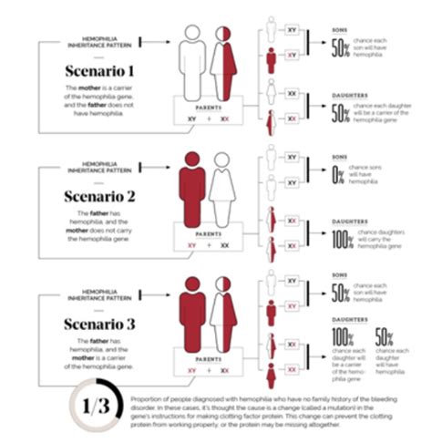 All About The Royal Disease Hemophilia