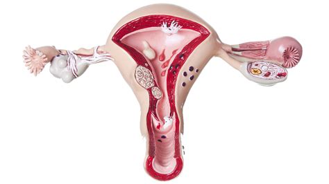 Cáncer De Cuello Uterino Cómo Prevenir Una Enfermedad Que No Suele