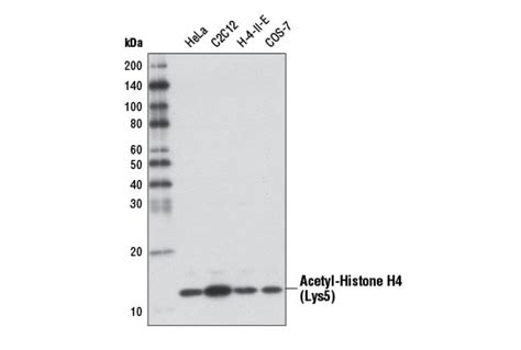 Acetyl Histone H4 Lys5 D12b3 Rabbit Mab Cell Signaling Technology