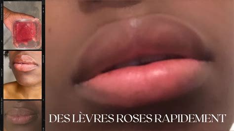 COMMENT AVOIR LES LÈVRES ROSES RAPIDEMENT lèvres foncées YouTube