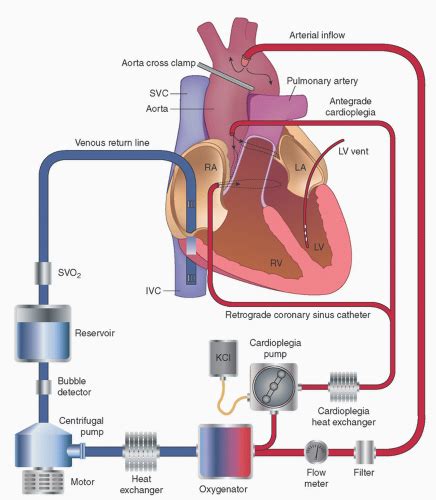 Blood Pumps Circuitry And Cannulation Techniques In Cardiopulmonary