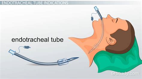 endotracheal tubes indications patient management video studycom