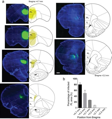 Excitatory Connections Between The Prelimbic And Infralimbic Medial