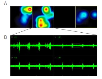 Neural Organoid Activity Assay Axion Biosystems