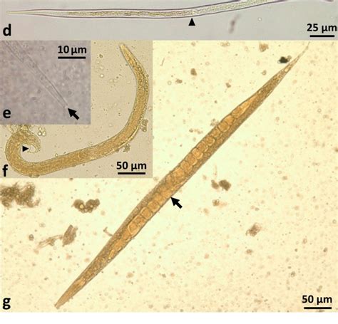 The Life Stages Of Strongyloides Stercoralis A Parasitic Female With Download Scientific