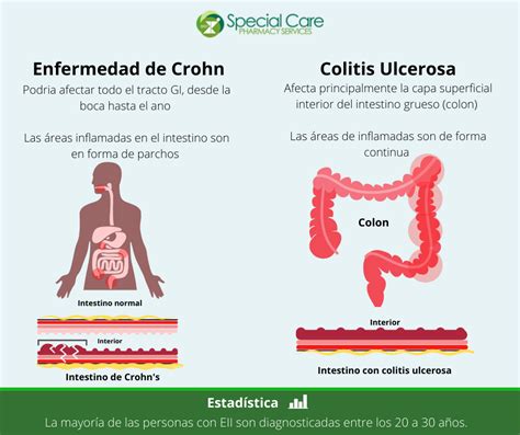 Qu Son Las Enfermedades Inflamatorias Del Intestino