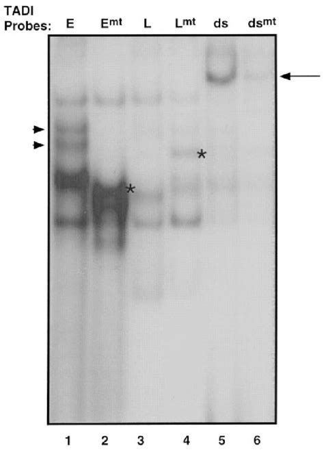 Comparison Of Nucleoprotein Complex Formation Between Wild Type And