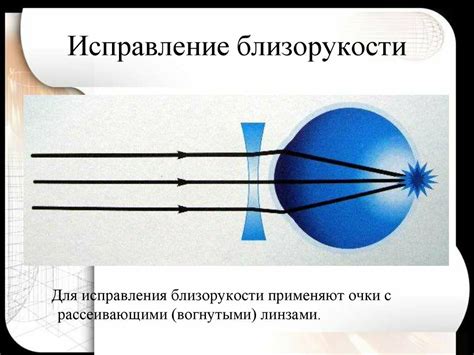 Глаз как оптическая система. Близорукость и дальнозоркость | Flashcards