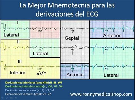 Derivaciones Y Anatomía Del Corazón Ekg Ecg Cardiología Enfermería Electrocardiografía