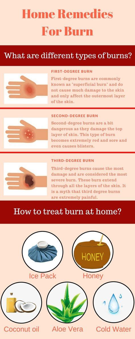 9 Effective Home Remedies For Burn That Really Works Infographics