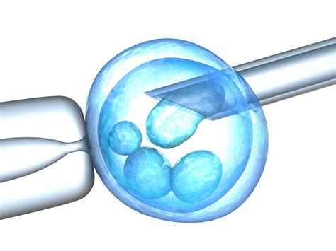 Fecundación In Vitro Icsi Clínica Bau Reproducción Asistida Y