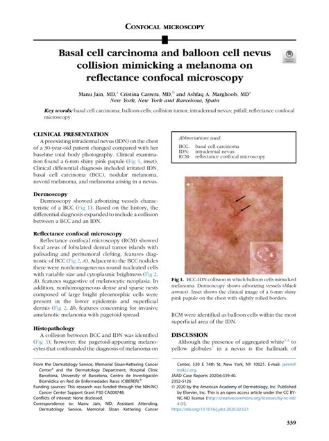 Pdf Basal Cell Carcinoma And Balloon Cell Nevus Collision Mimicking A