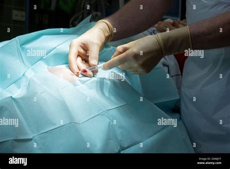 A Doctor Performs A Knee Puncture In An Operating Room With A Cannula