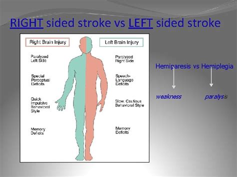 Pathophysiology Of Stroke Wanda Lovitz Aprn Objectives Stroke