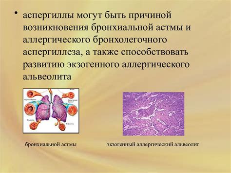 АСПЕРГИЛЛЕЗ — презентация