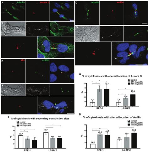 Mislocalization Of Proteins During Cytokinesis Rpe And Lc Hk Cells