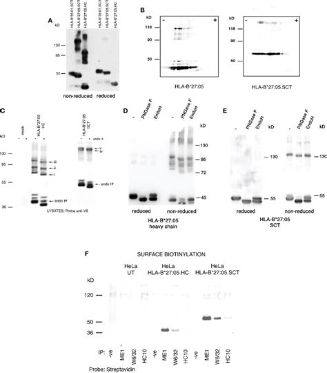 Figure 2 from Intrinsic Folding Properties of the HLA-B27 Heavy Chain ...